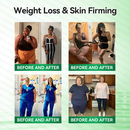 🎐🎐𝐂𝐚𝐫𝐞𝐔𝐩𝐥𝐢𝐟𝐭® 𝑴𝒆𝒕𝒂𝒃𝒐𝒍𝒊𝒄 𝑵𝒂𝒏𝒐 𝑴𝒊𝒄𝒓𝒐𝒏𝒆𝒆𝒅𝒍𝒆 𝑷𝒂𝒕𝒄𝒉🇺🇸(𝐉𝐮𝐬𝐭 𝐨𝐧𝐜𝐞 𝐚 𝐝𝐚𝐲, 𝐯𝐢𝐬𝐢𝐛𝐥𝐞 𝐜𝐡𝐚𝐧𝐠𝐞𝐬 𝐢𝐧 𝟕 𝐝𝐚𝐲𝐬）𝘽𝙚𝙧𝙗𝙚𝙧𝙞𝙣𝙚 + 𝙈𝙤𝙧𝙞𝙣𝙜𝙖 𝙁𝙤𝙧𝙢𝙪𝙡𝙖 ✅ 𝐅𝐨𝐫 𝐨𝐛𝐞𝐬𝐢𝐭𝐲, 𝗟𝗼𝗼𝘀𝗲 𝘀𝗸𝗶𝗻,𝐝𝐢𝐚𝐛𝐞𝐭𝐞𝐬, 𝐬𝐥𝐞𝐞𝐩 𝐚𝐩𝐧𝐞𝐚, 𝐣𝐨𝐢𝐧𝐭 𝐢𝐬𝐬𝐮𝐞𝐬, 𝐚𝐧𝐝 𝐦𝐨𝐫𝐞 💯💯