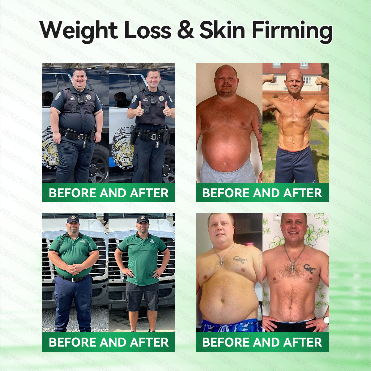 🎐🎐𝐂𝐚𝐫𝐞𝐔𝐩𝐥𝐢𝐟𝐭® 𝑴𝒆𝒕𝒂𝒃𝒐𝒍𝒊𝒄 𝑵𝒂𝒏𝒐 𝑴𝒊𝒄𝒓𝒐𝒏𝒆𝒆𝒅𝒍𝒆 𝑷𝒂𝒕𝒄𝒉🇺🇸(𝐉𝐮𝐬𝐭 𝐨𝐧𝐜𝐞 𝐚 𝐝𝐚𝐲, 𝐯𝐢𝐬𝐢𝐛𝐥𝐞 𝐜𝐡𝐚𝐧𝐠𝐞𝐬 𝐢𝐧 𝟕 𝐝𝐚𝐲𝐬）𝘽𝙚𝙧𝙗𝙚𝙧𝙞𝙣𝙚 + 𝙈𝙤𝙧𝙞𝙣𝙜𝙖 𝙁𝙤𝙧𝙢𝙪𝙡𝙖 ✅ 𝐅𝐨𝐫 𝐨𝐛𝐞𝐬𝐢𝐭𝐲, 𝗟𝗼𝗼𝘀𝗲 𝘀𝗸𝗶𝗻,𝐝𝐢𝐚𝐛𝐞𝐭𝐞𝐬, 𝐬𝐥𝐞𝐞𝐩 𝐚𝐩𝐧𝐞𝐚, 𝐣𝐨𝐢𝐧𝐭 𝐢𝐬𝐬𝐮𝐞𝐬, 𝐚𝐧𝐝 𝐦𝐨𝐫𝐞 💯💯
